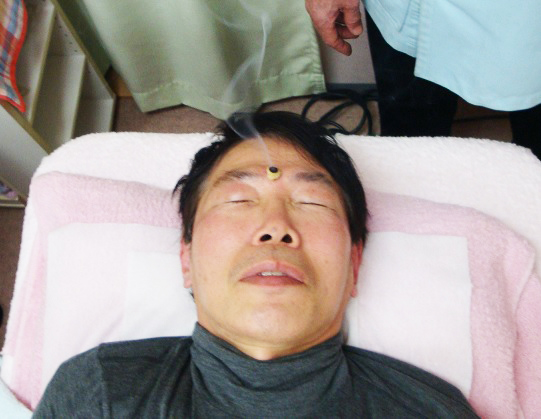 花粉症・鼻炎の鍼灸治療